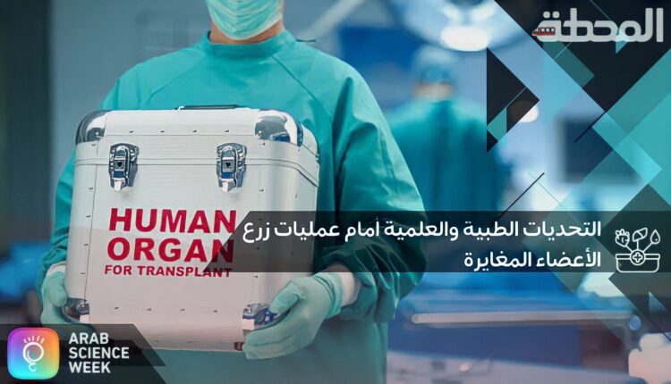 زرع الأعضاء