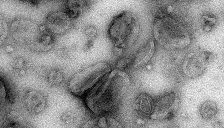 الجهاز المناعي الخلايا السرطانية