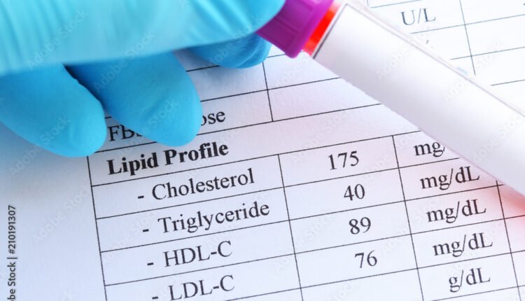 أمراض القلب